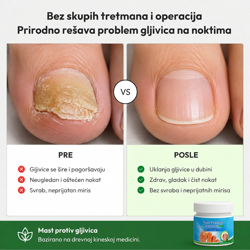 Mast Protiv Gljivičnih Infekcija - Slika 3